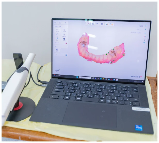 スキャナー（Trios）