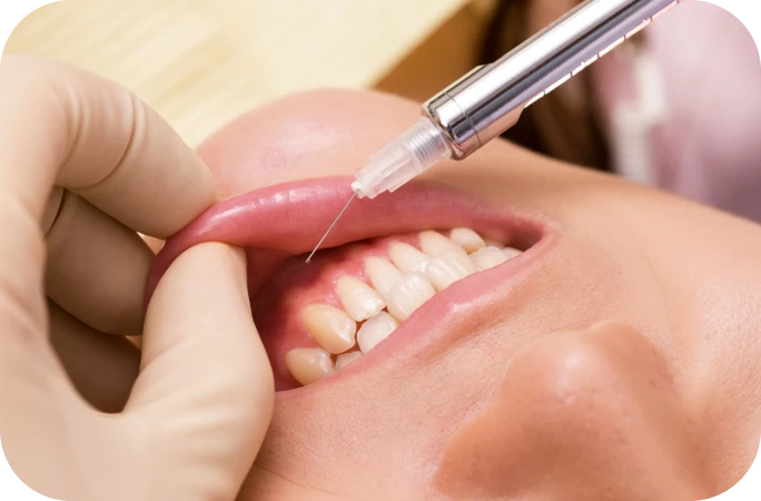 エムドゲイン法