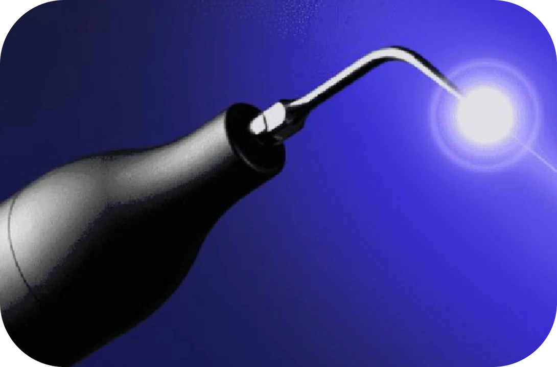 ブルーラジカル歯周病治療