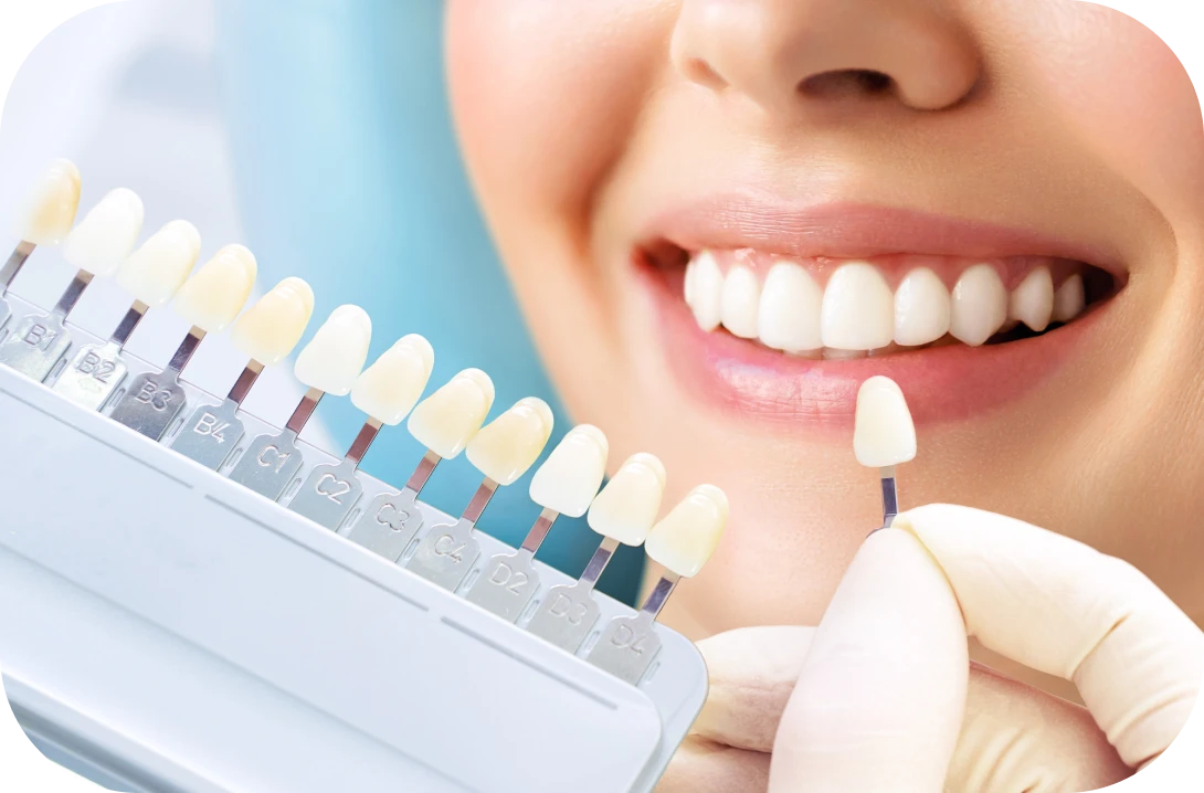 ホワイトニング